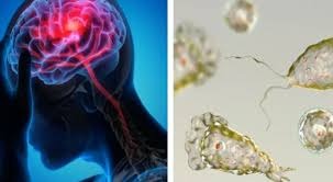 വേനല്‍ക്കാലത്ത് അമീബിക് മസ്തിഷ്‌ക ജ്വരം വര്‍ധിക്കാന്‍ സാധ്യത; ജാഗ്രത നിര്‍ദേശം നല്‍കി ആരോഗ്യ വകുപ്പ്